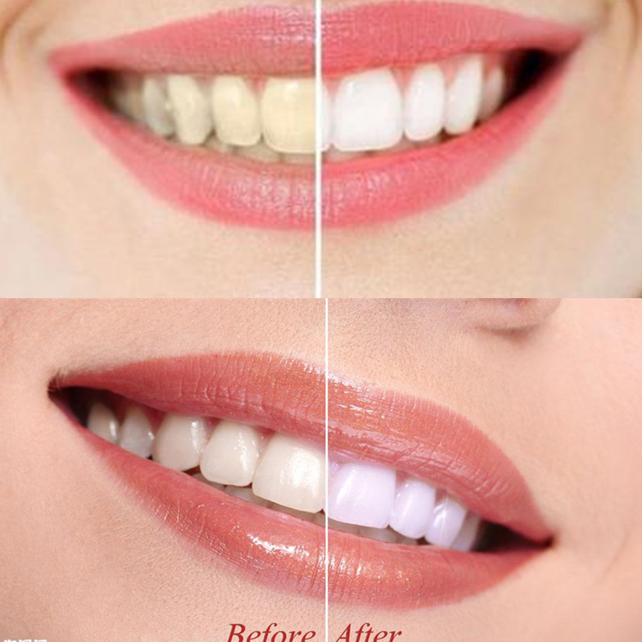 Bamboo Charcoal Teeth Tooth De - огляд і ціна Teeth Whitening Ai