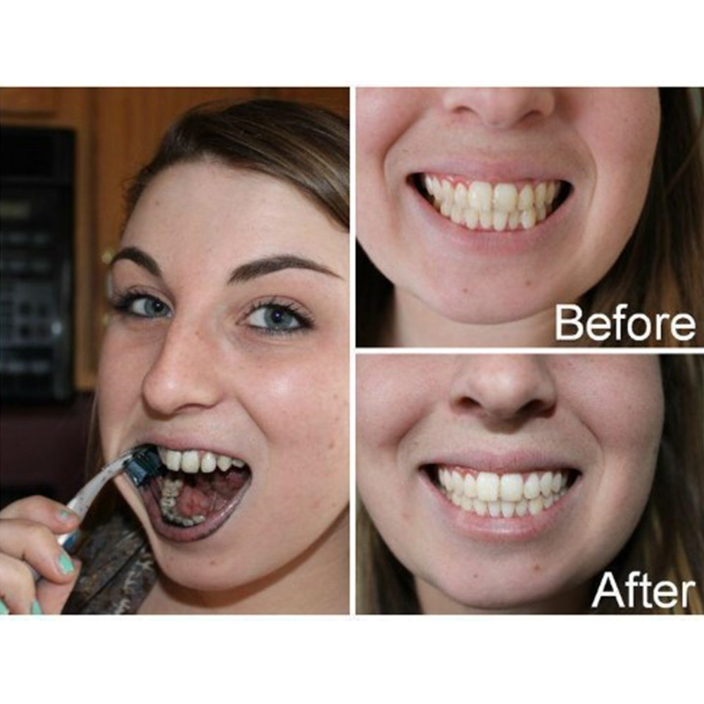 Bamboo Charcoal Teeth Tooth De - огляд і ціна Teeth Whitening Ai