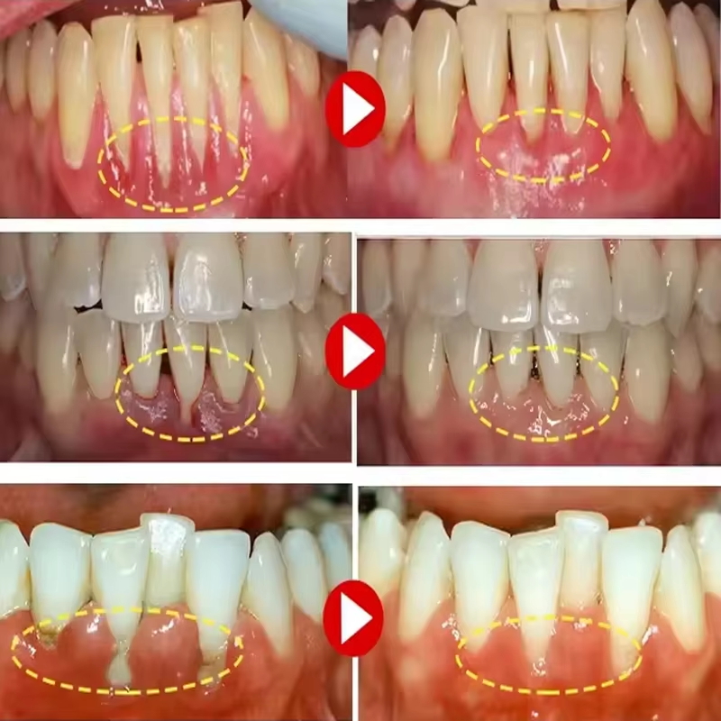 Teeth Whitening Gel Gum Repair - огляд і ціна Teeth Whitening Gum