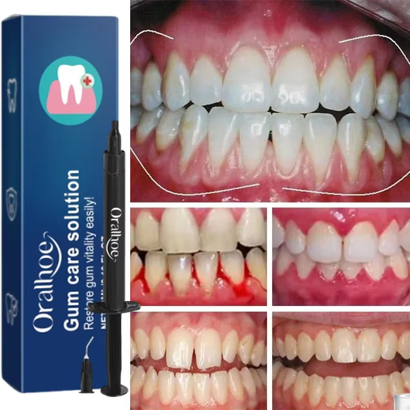 Teeth Whitening Gel Gum Repair - огляд і ціна Teeth Whitening Gum