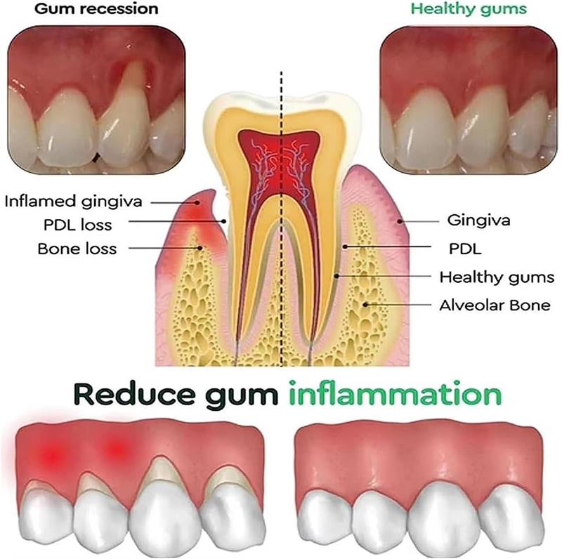 Teeth Whitening Gel Gum Repair - огляд і ціна Teeth Whitening Gum