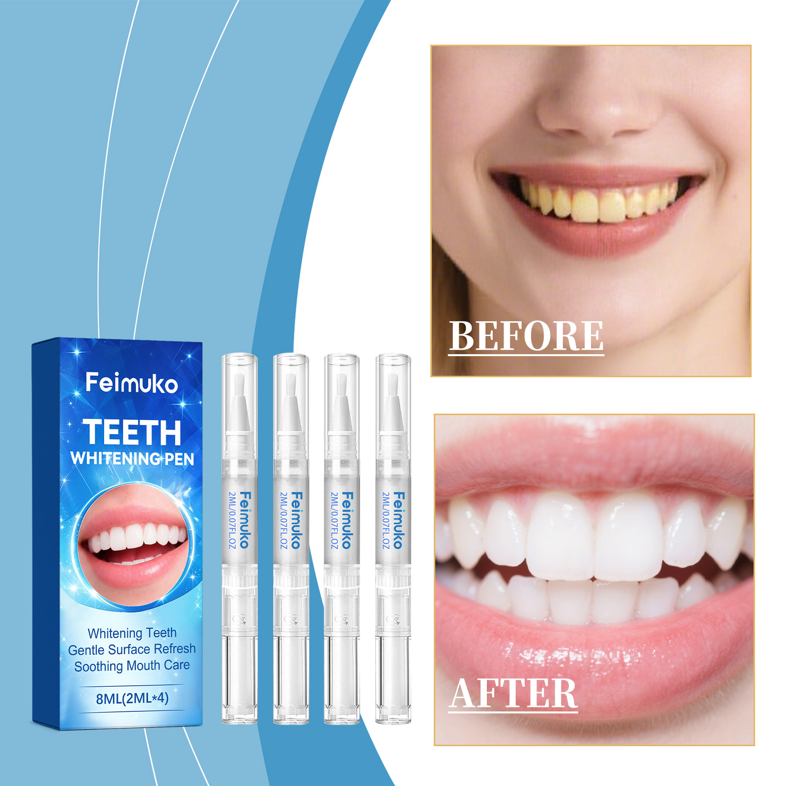 Feimuko 8ml Teeth Gel Pen Gent - огляд і ціна Teeth Whitening Pens