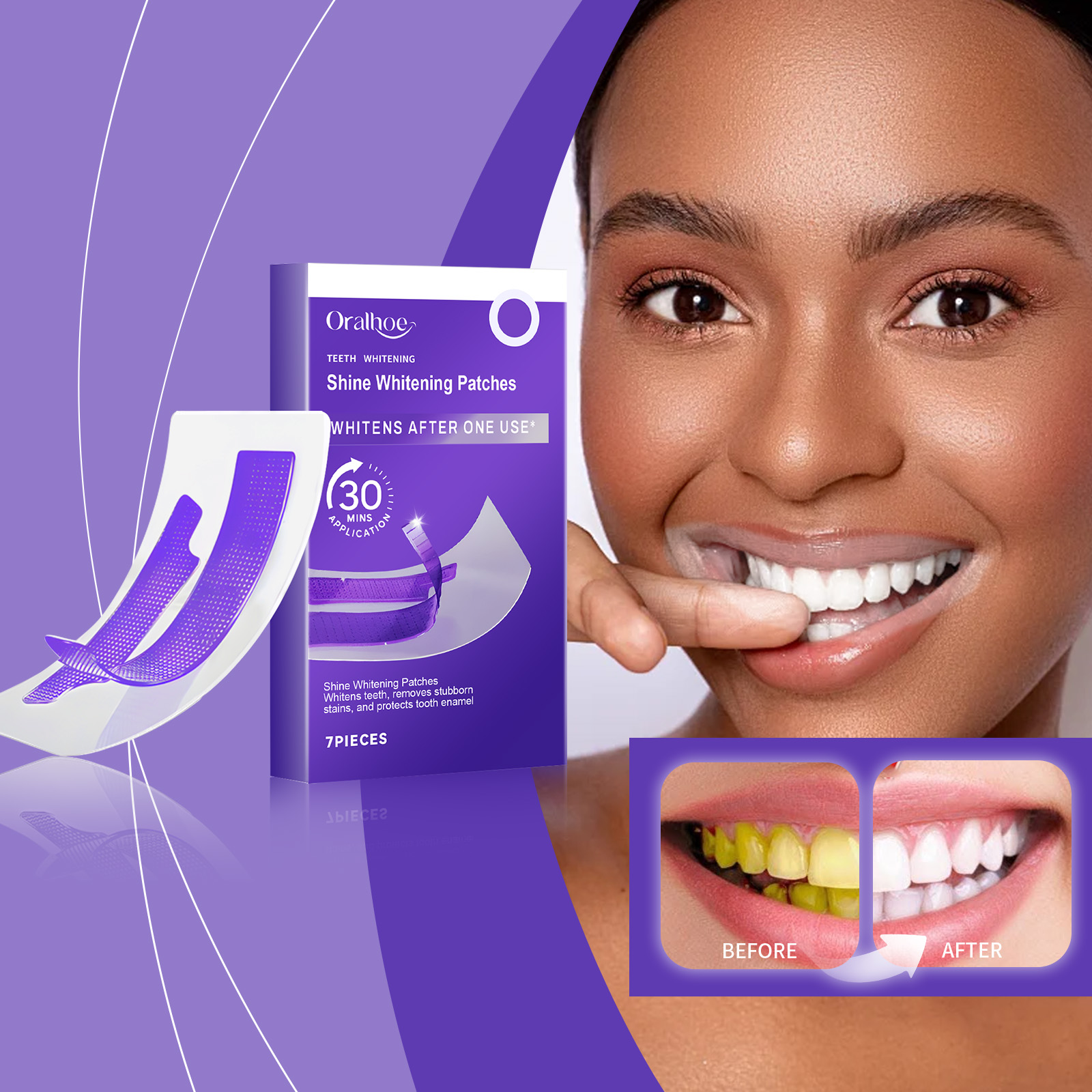Purple Teeth Whitening Strips  - огляд і ціна Teeth Whitening Bleach
