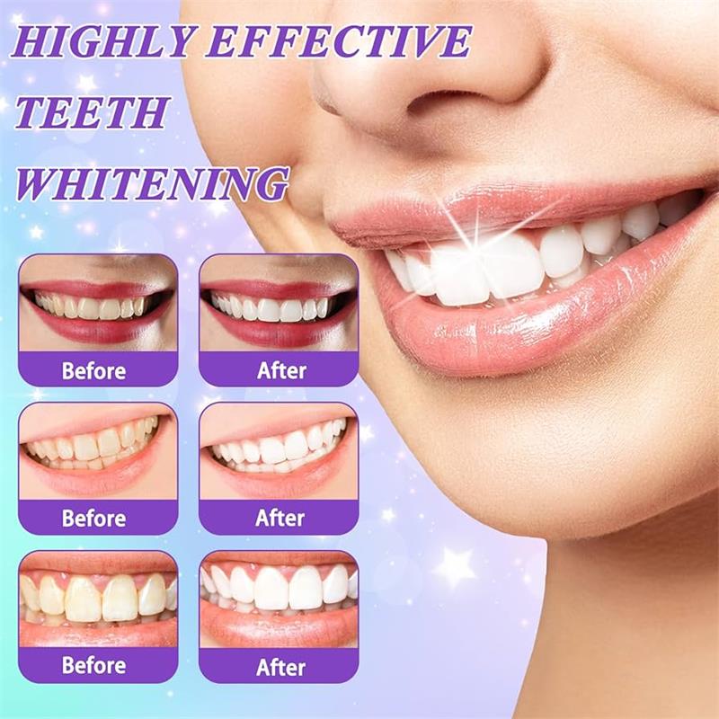 9D Purple Teeth Whitening Toot - огляд і ціна Teeth Whitening Gum