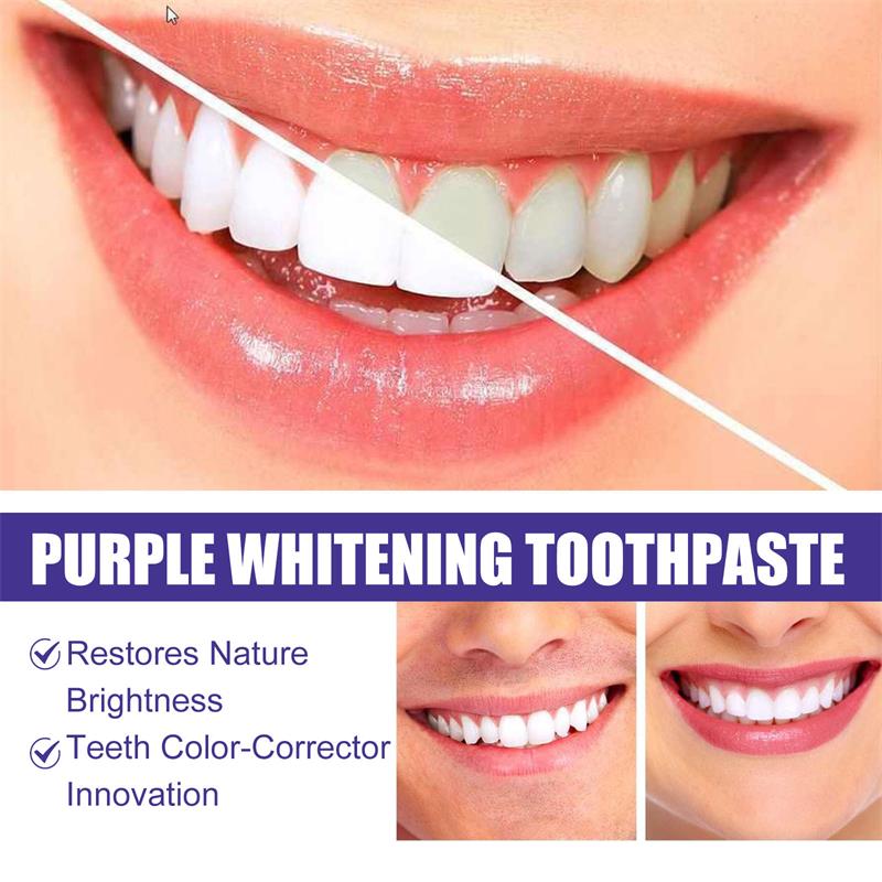 9D Purple Teeth Whitening Toot - огляд і ціна Teeth Whitening Gum