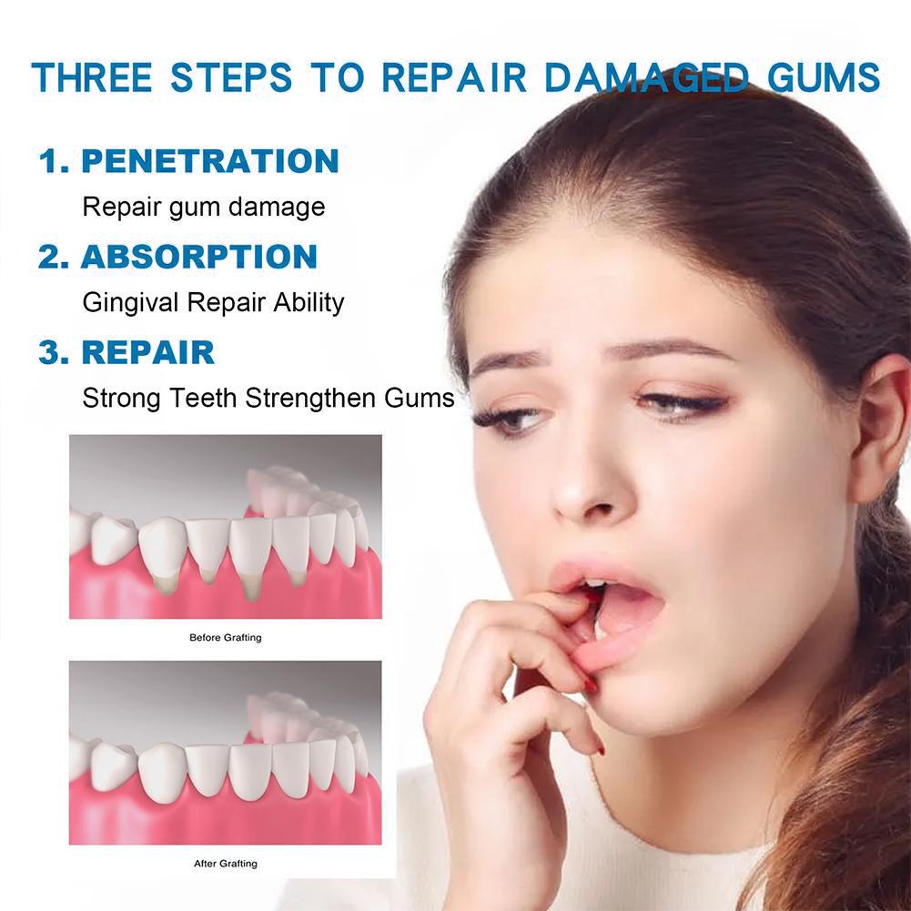 Dental Care Toothpaste Natural - огляд і ціна Teeth Whitening Gum