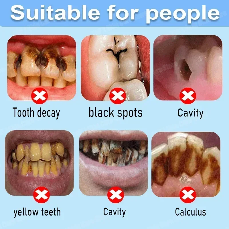 Anti Decay Toothpaste Repairs  - огляд і ціна Teeth Whitening Gum