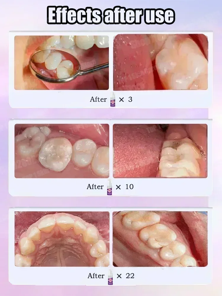 Hot sales Best-selling, Scient - огляд і ціна Teeth Whitening Gum