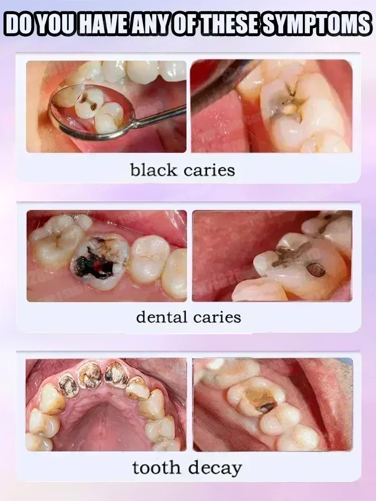 Hot sales Best-selling, Scient - огляд і ціна Teeth Whitening Gum